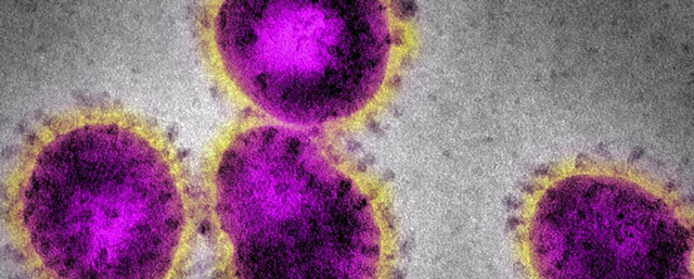 WHO：新型コロナウイルスの新型コロナウイルスの電子顕微鏡写真像（Getty-images）